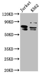 THEMIS / SPOT Antibody - Positive Western Blot detected in Jurkat whole cell lysate, K562 whole cell lysate. All lanes: THEMIS antibody at 7.6 µg/ml Secondary Goat polyclonal to rabbit IgG at 1/50000 dilution. Predicted band size: 74, 70, 63, 78 KDa. Observed band size: 74, 70 KDa