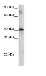 THG-1 / TSC22D4 Antibody - SP2/0 Cell Lysate.  This image was taken for the unconjugated form of this product. Other forms have not been tested.