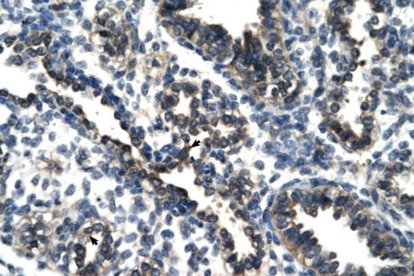 THG-1 / TSC22D4 Antibody - TSC22D4 antibody ARP30107_T100-NP_112197-TSC22D4 (TSC22 domain family, member 4) Antibody IHC of formalin-fixed, paraffin-embedded human Lung. Positive label: Alveolar cells indicated with arrows. Antibody concentration 4-8 ug/ml. Magnification 400X.  This image was taken for the unconjugated form of this product. Other forms have not been tested.