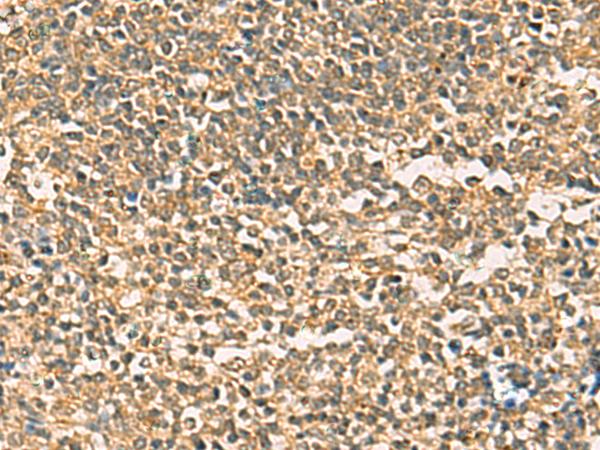 THG1L Antibody - Immunohistochemistry of paraffin-embedded Human tonsil tissue  using THG1L Polyclonal Antibody at dilution of 1:50(×200)