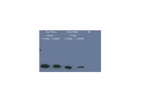 Thioredoxin / TRX Tag Antibody