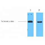 Thioredoxin / TRX Tag Antibody - Western blot of Trx-Tag antibody