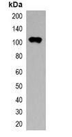 Thioredoxin / TRX Tag Antibody - Western blot analysis of over-expressed Trx-tagged protein in 293T cell lysate.