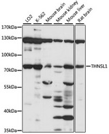 THNSL1 Antibody - Western blot analysis of extracts of various cell lines, using THNSL1 antibody at 1:1000 dilution. The secondary antibody used was an HRP Goat Anti-Rabbit IgG (H+L) at 1:10000 dilution. Lysates were loaded 25ug per lane and 3% nonfat dry milk in TBST was used for blocking. An ECL Kit was used for detection and the exposure time was 30s.