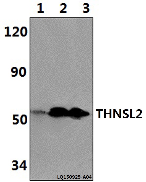 THNSL2 Antibody - Western blot of THNSL2 antibody at 1:500 dilution. Lane 1: HepG2 whole cell lysate (40 ug). Lane 2: H9C2 whole cell lysate (40 ug). Lane 3: RAW264.7 whole cell lysate (40 ug).