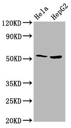 THNSL2 Antibody - Western Blot Positive WB detected in: Hela whole cell lysate, HepG2 whole cell lysate All Lanes: THNSL2 antibody at 4.3µg/ml Secondary Goat polyclonal to rabbit IgG at 1/50000 dilution Predicted band size: 55, 46, 43, 48, 28 KDa Observed band size: 55 KDa