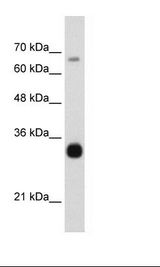 THOC3 Antibody - HepG2 Cell Lysate.  This image was taken for the unconjugated form of this product. Other forms have not been tested.