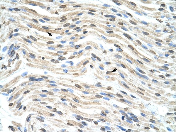 THOC3 Antibody - THOC3 antibody ARP41052_T100-NP_115737-THOC3 (THO complex 3) Antibody was used in IHC to stain formalin-fixed, paraffin-embedded human heart.  This image was taken for the unconjugated form of this product. Other forms have not been tested.