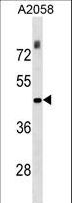 THOC3 Antibody - THOC3 Antibody western blot of A2058 cell line lysates (35 ug/lane). The THOC3 antibody detected the THOC3 protein (arrow).