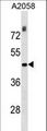 THOC3 Antibody - THOC3 Antibody western blot of A2058 cell line lysates (35 ug/lane). The THOC3 antibody detected the THOC3 protein (arrow).