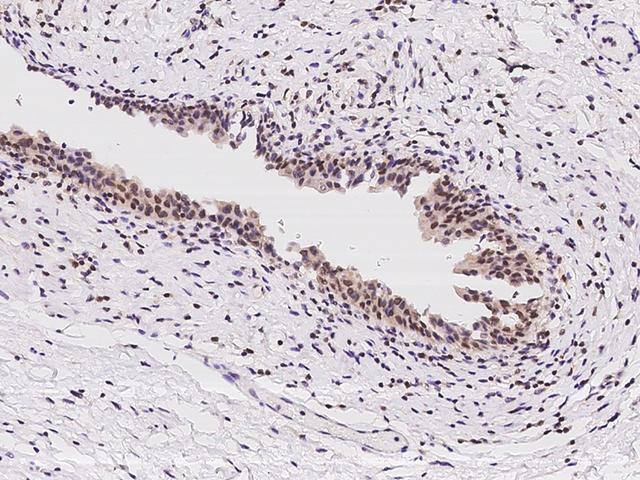 THOC3 Antibody - Immunochemical staining of human THOC3 in human urinary bladder with rabbit polyclonal antibody at 1:250 dilution, formalin-fixed paraffin embedded sections.