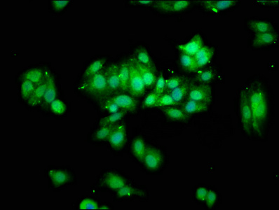 THOC5 Antibody - Immunofluorescence staining of HepG2 cells at a dilution of 1:100, counter-stained with DAPI. The cells were fixed in 4% formaldehyde, permeabilized using 0.2% Triton X-100 and blocked in 10% normal Goat Serum. The cells were then incubated with the antibody overnight at 4 °C.The secondary antibody was Alexa Fluor 488-congugated AffiniPure Goat Anti-Rabbit IgG (H+L) .