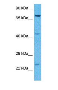 THOC5 Antibody - Western blot of THOC5 Antibody with human Jurkat Whole Cell lysate.  This image was taken for the unconjugated form of this product. Other forms have not been tested.