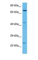 THOC5 Antibody - Western blot of THOC5 Antibody with human Jurkat Whole Cell lysate.  This image was taken for the unconjugated form of this product. Other forms have not been tested.