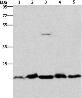 THOC7 Antibody - Western blot analysis of Mouse spleen and human fetal liver tissue, HeLa cell and mouse testis tissue, A431 cell, using THOC7 Polyclonal Antibody at dilution of 1:500.