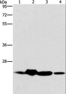 THOC7 Antibody - Western blot analysis of Mouse spleen and human fetal liver tissue, HeLa cell and human fetal brain tissue, using THOC7 Polyclonal Antibody at dilution of 1:450.