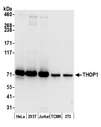 THOP1 / Thimet Oligopeptidase Antibody - Detection of human and mouse THOP1 by western blot. Samples: Whole cell lysate (15 µg) from HeLa, HEK293T, Jurkat, mouse TCMK-1, and mouse NIH 3T3 cells prepared using NETN lysis buffer. Antibody: Affinity purified rabbit anti-THOP1 antibody used for WB at 0.04 µg/ml. Detection: Chemiluminescence with an exposure time of 10 seconds.