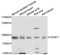 THOP1 / Thimet Oligopeptidase Antibody - Western blot analysis of extracts of various cell lines.