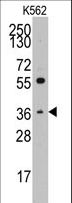 THPO / TPO / Thrombopoietin Antibody - Western blot of anti-THPO antibody in K562 cell line lysates (35 ug/lane). THPO(arrow) was detected using the purified antibody.