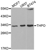THPO / TPO / Thrombopoietin Antibody - Western blot analysis of extracts of various cell lines.