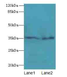 THPO / TPO / Thrombopoietin Antibody - Western blot. All lanes: Thpo antibody at 4 ug/ml. Lane 1: Mouse liver tissue. Lane 2: 293T whole cell lysate. Secondary Goat polyclonal to Rabbit IgG at 1:10000 dilution. Predicted band size: 35 kDa. Observed band size: 35 kDa.