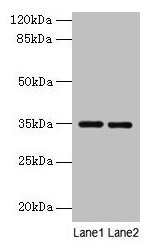 THPO / TPO / Thrombopoietin Antibody - Western blot All lanes: Thpo antibody at 4µg/ml Lane 1: Mouse liver tissue Lane 2: 293T whole cell lysate Secondary Goat polyclonal to rabbit IgG at 1/10000 dilution Predicted band size: 35 kDa Observed band size: 35 kDa