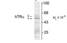THR Alpha 1+2 Antibody - Western blot of hippocampal lysate showing specific immunolabeling of the -50k TR-a1 and the -58k TR-a2 protein.