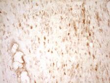 THRA / THR Alpha Antibody - Immunohistochemical staining of paraffin-embedded Human Ovary tissue within the normal limits using anti-THRA mouse monoclonal antibody. (Heat-induced epitope retrieval by 1 mM EDTA in 10mM Tris, pH8.5, 120C for 3min,