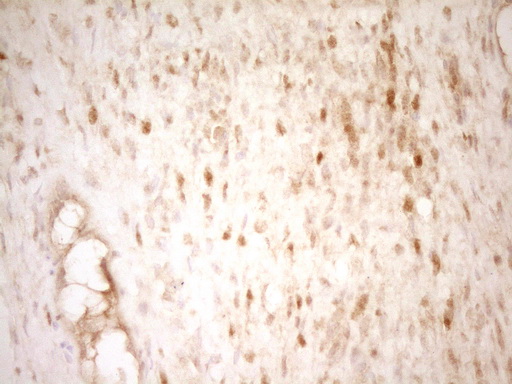 THRA / THR Alpha Antibody - IHC of paraffin-embedded Human Ovary tissue using anti-THRA mouse monoclonal antibody. (Heat-induced epitope retrieval by 1 mM EDTA in 10mM Tris, pH8.5, 120°C for 3min).