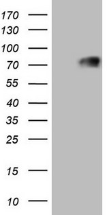 THRA / THR Alpha Antibody - HEK293T cells were transfected with the pCMV6-ENTRY control. (Left lane) or pCMV6-ENTRY THRA. (Right lane) cDNA for 48 hrs and lysed. Equivalent amounts of cell lysates. (5 ug per lane) were separated by SDS-PAGE and immunoblotted with anti-THRA.