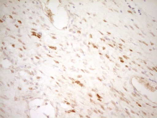 THRA / THR Alpha Antibody - IHC of paraffin-embedded Human Ovary tissue using anti-THRA mouse monoclonal antibody. (Heat-induced epitope retrieval by 1 mM EDTA in 10mM Tris, pH8.5, 120°C for 3min).