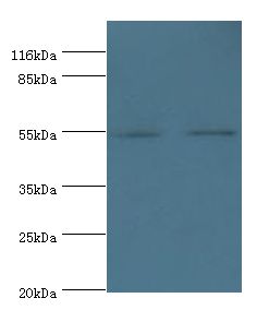 THRA / THR Alpha Antibody - Western blot. All lanes: Thyroid hormone receptor alpha polyclonal antibody at 2 ug/ml. Lane 1: Jurkat whole cell lysate Lane 2: A431 whole cell lysate. Secondary antibody: goat polyclonal to rabbit at 1:10000 dilution. Predicted band size: 55 kDa. Observed band size: 55 kDa.  This image was taken for the unconjugated form of this product. Other forms have not been tested.