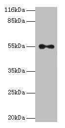 THRA / THR Alpha Antibody - Western blot All lanes: Thyroid hormone receptor alpha polyclonal antibody at 2µg/ml Lane 1: Jurkat whole cell lysate Lane 2: A431 whole cell lysate Secondary Goat polyclonal to rabbit IgG at 1/10000 dilution Predicted band size: 55, 47, 51 kDa Observed band size: 55 kDa