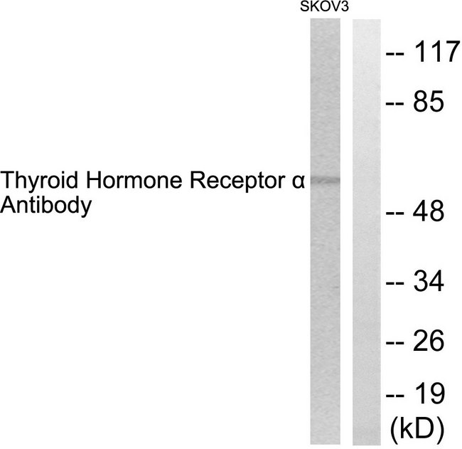 THRA / THR Alpha Antibody - Western blot analysis of lysates from SKOV3 cells, using Thyroid Hormone Receptor alpha Antibody. The lane on the right is blocked with the synthesized peptide.