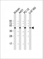 THRA / THR Alpha Antibody - All lanes: Anti-THRA Antibody (N-Term) at 1:2000 dilution. Lane 1: mouse brain lysate. Lane 2: A431 whole cell lysate. Lane 3: PC-12 whole cell lysate. Lane 4: U-87 MG whole cell lysate Lysates/proteins at 20 ug per lane. Secondary Goat Anti-Rabbit IgG, (H+L), Peroxidase conjugated at 1:10000 dilution. Predicted band size: 55 kDa. Blocking/Dilution buffer: 5% NFDM/TBST.