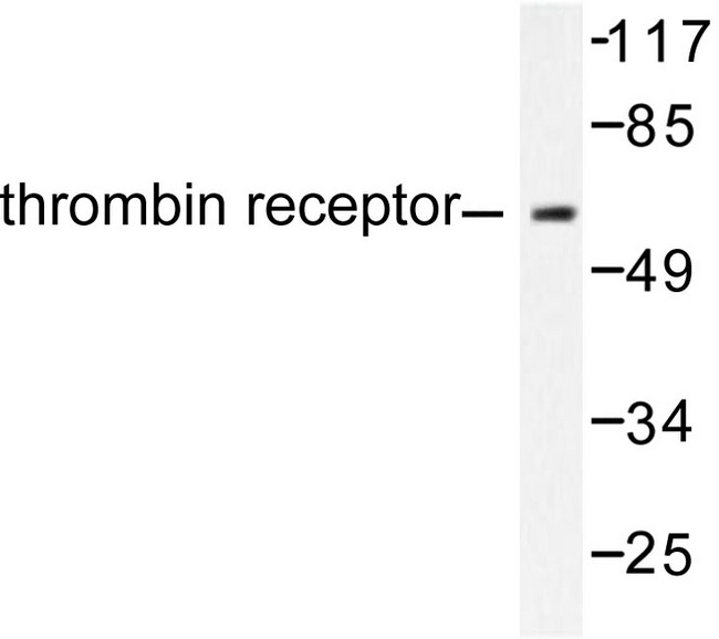 THRA / THR Alpha Antibody - Western blot of Thyroid Hormone Receptor (A19) pAb in extracts from SKOV3 cells.
