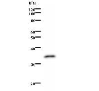 THRA / THR Alpha Antibody - Western blot analysis of immunized recombinant protein, using anti-THRA monoclonal antibody.
