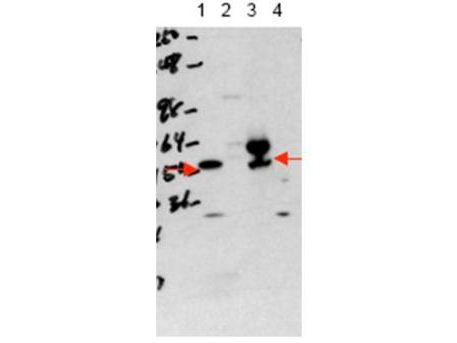 THRA / THR Alpha Antibody - Western blot using the affinity purified anti-THRA antibody shows detection of purified recombinant THRA (lane 1) and THRA present in a 293 cell lysate after transient transfection with THRA (lane 3). No staining is evident in lysates from mock-transfected 293 cells (lane 2). Endogenous THRA is not detected in mouse brain whole cell lysate (lane 4). Nuclear extracts may be required to detect endogenous THRA as the protein localizes within the nucleus. The band at ~55 kDa, indicated by the arrowhead, corresponds to THRA.