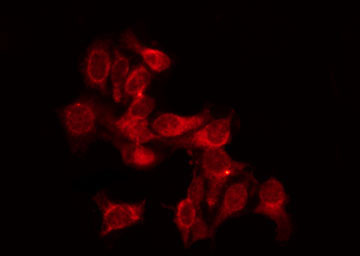 THRA / THR Alpha Antibody - Staining SK-OV3 cells by IF/ICC. The samples were fixed with PFA and permeabilized in 0.1% Triton X-100, then blocked in 10% serum for 45 min at 25°C. The primary antibody was diluted at 1:200 and incubated with the sample for 1 hour at 37°C. An Alexa Fluor 594 conjugated goat anti-rabbit IgG (H+L) Ab, diluted at 1/600, was used as the secondary antibody.
