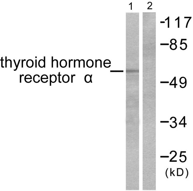 THRA / THR Alpha Antibody - Western blot analysis of extracts from SKOV3 cells, using Thyroid Hormone Receptor a antibody.