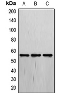 THRA / THR Alpha Antibody - Western blot analysis of THRA expression in MCF7 (A); Jurkat (B); HepG2 (C) whole cell lysates.
