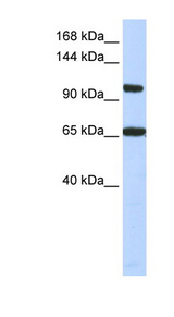 THRAP3 / TRAP150 Antibody - THRAP3 antibody Western blot of Fetal Muscle lysate. This image was taken for the unconjugated form of this product. Other forms have not been tested.