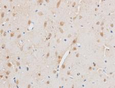 THRAP3 / TRAP150 Antibody - Immunohistochemistry of paraffin-embedded Mouse brain using THRAP3 Polyclonal Antibody at dilution of 1:50.