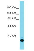 THRAP3 / TRAP150 Antibody - THRAP3 / TRAP150 antibody Western Blot of Mouse Liver. Antibody dilution: 1 ug/ml.  This image was taken for the unconjugated form of this product. Other forms have not been tested.