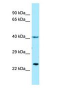 Thromboxane A2 Receptor Antibody - TBXA2R/Thromboxane A2 Receptor antibody Western Blot of Fetal Brain.  This image was taken for the unconjugated form of this product. Other forms have not been tested.