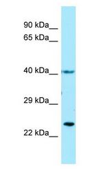 Thromboxane A2 Receptor Antibody - TBXA2R/Thromboxane A2 Receptor antibody Western Blot of Fetal Brain.  This image was taken for the unconjugated form of this product. Other forms have not been tested.