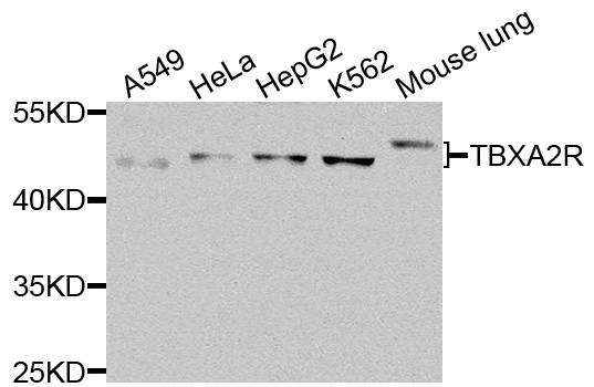 Thromboxane A2 Receptor Antibody - Western blot analysis of extracts of various cells.