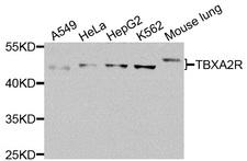 Thromboxane A2 Receptor Antibody - Western blot analysis of extracts of various cells.