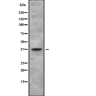 Thromboxane A2 Receptor Antibody - Western blot analysis of TAS2R using 293 whole cells lysates