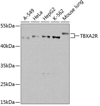 Thromboxane A2 Receptor Antibody - Western blot analysis of extracts of various cell lines using TBXA2R Polyclonal Antibody at dilution of 1:1000.